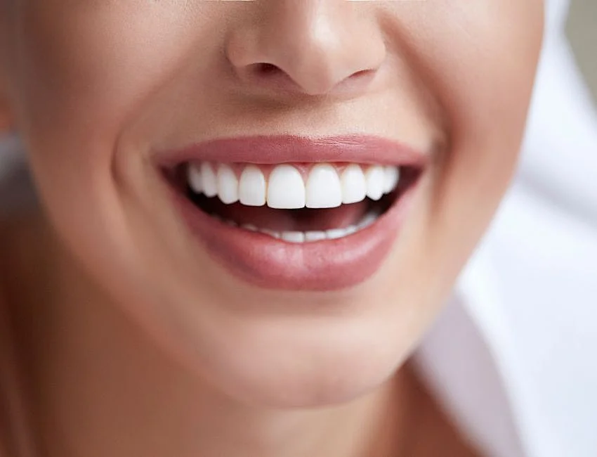 teeth whitening in preston