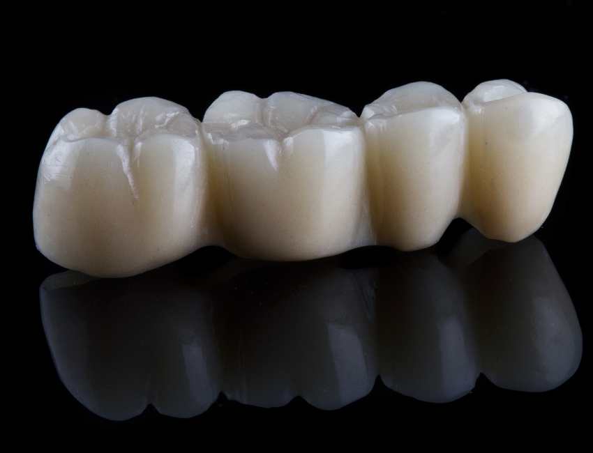 Dental Crowns